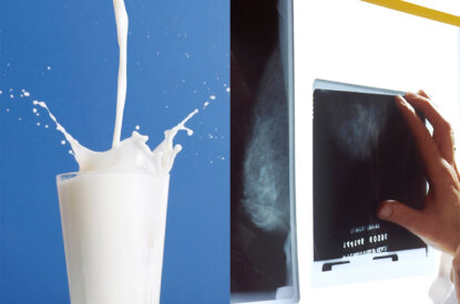 Collage Milch und Brustscreening
